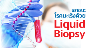 "Liquid Biopsy” จะช่วยเพิ่มโอกาสรอดให้กับผู้ป่วยมะเร็งได้อย่างไร?